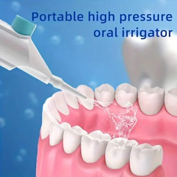Irrigateur buccal haute pression portable – Nettoyeur dentaire à eau pour l’hygiène des dents – Brosse à eau manuelle pour un nettoyage efficace – Image 2
